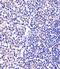 Polycomb protein EED antibody, PA5-72224, Invitrogen Antibodies, Immunohistochemistry paraffin image 