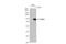 Forkhead Box P2 antibody, GTX135285, GeneTex, Western Blot image 