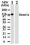 DNA Methyltransferase 3 Alpha antibody, NB100-56521, Novus Biologicals, Western Blot image 