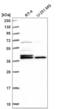 H2A Histone Family Member Y antibody, NBP2-56819, Novus Biologicals, Western Blot image 