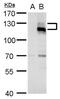 AXL Receptor Tyrosine Kinase antibody, PA5-77874, Invitrogen Antibodies, Western Blot image 