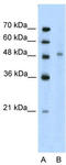 Kin17 DNA And RNA Binding Protein antibody, TA330235, Origene, Western Blot image 