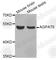 Glycerol-3-Phosphate Acyltransferase 4 antibody, A7538, ABclonal Technology, Western Blot image 