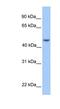 Ankyrin Repeat And SOCS Box Containing 6 antibody, NBP1-58945, Novus Biologicals, Western Blot image 