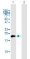 Solute Carrier Family 11 Member 1 antibody, H00006556-B01P, Novus Biologicals, Western Blot image 