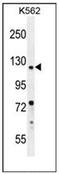 DEAD/H-Box Helicase 11 antibody, AP51216PU-N, Origene, Western Blot image 