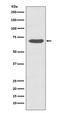 Protein Kinase C Zeta antibody, P01796, Boster Biological Technology, Western Blot image 