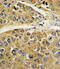 Serpin Family A Member 7 antibody, 62-422, ProSci, Immunohistochemistry paraffin image 