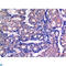 Glycogen Synthase Kinase 3 Beta antibody, LS-C814211, Lifespan Biosciences, Immunohistochemistry paraffin image 