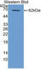 Thrombopoietin antibody, LS-C314414, Lifespan Biosciences, Western Blot image 