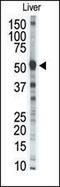 Neutrophil collagenase antibody, 62-181, ProSci, Western Blot image 