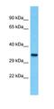 Family With Sequence Similarity 185 Member A antibody, orb326994, Biorbyt, Western Blot image 