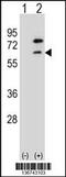 Zinc Finger And BTB Domain Containing 7B antibody, 58-864, ProSci, Western Blot image 