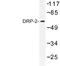 Dihydropyrimidinase Like 2 antibody, LS-C177337, Lifespan Biosciences, Western Blot image 