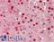 Transketolase antibody, LS-B13075, Lifespan Biosciences, Immunohistochemistry paraffin image 