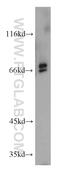 Anti-Mullerian Hormone antibody, 14461-1-AP, Proteintech Group, Western Blot image 