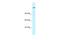 AT-Rich Interaction Domain 4A antibody, A05425, Boster Biological Technology, Western Blot image 