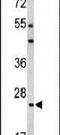 BCL2 Related Protein A1 antibody, PA5-24561, Invitrogen Antibodies, Western Blot image 
