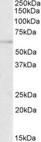 Transcription Factor EB antibody, TA302788, Origene, Western Blot image 