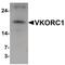 Vitamin K Epoxide Reductase Complex Subunit 1 antibody, PA5-34358, Invitrogen Antibodies, Western Blot image 