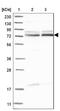 Zinc Finger And BTB Domain Containing 2 antibody, NBP1-88787, Novus Biologicals, Western Blot image 