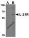 Interleukin 21 Receptor antibody, 2469, ProSci, Western Blot image 