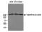 DNA Topoisomerase II Alpha antibody, PA5-40274, Invitrogen Antibodies, Western Blot image 