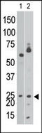 BCL2 Interacting Protein 3 Like antibody, TA302077, Origene, Western Blot image 