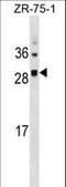 SPC25 Component Of NDC80 Kinetochore Complex antibody, LS-C157073, Lifespan Biosciences, Western Blot image 