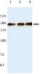 Mitogen-Activated Protein Kinase Kinase Kinase 5 antibody, AP06018PU-N, Origene, Western Blot image 
