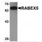 RAB Guanine Nucleotide Exchange Factor 1 antibody, MBS151191, MyBioSource, Western Blot image 