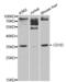 CD1d Molecule antibody, abx001460, Abbexa, Western Blot image 