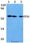 ETS Proto-Oncogene 1, Transcription Factor antibody, A00931-3, Boster Biological Technology, Western Blot image 
