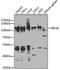Eukaryotic Elongation Factor 2 Kinase antibody, A5404, ABclonal Technology, Western Blot image 