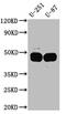 Serpin Family E Member 1 antibody, CSB-RA156066A0HU, Cusabio, Western Blot image 