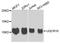 Ubiquinol-Cytochrome C Reductase, Complex III Subunit X antibody, A4674, ABclonal Technology, Western Blot image 