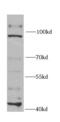 Exonuclease 1 antibody, FNab02891, FineTest, Western Blot image 