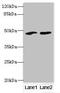 Spermatogenic Leucine Zipper 1 antibody, MBS7001132, MyBioSource, Western Blot image 