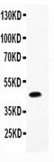 Chymase 1 antibody, PA5-79053, Invitrogen Antibodies, Western Blot image 