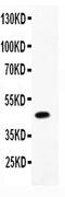 Chymase 1 antibody, PA5-79053, Invitrogen Antibodies, Western Blot image 