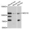 Mov10 RISC Complex RNA Helicase antibody, LS-C332940, Lifespan Biosciences, Western Blot image 