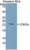 Glucokinase regulatory protein antibody, LS-C314243, Lifespan Biosciences, Western Blot image 