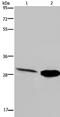 Carbonic Anhydrase 3 antibody, TA322662, Origene, Western Blot image 