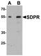 Caveolae Associated Protein 1 antibody, LS-B10088, Lifespan Biosciences, Western Blot image 