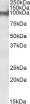 Plakophilin 2 antibody, NBP1-72054, Novus Biologicals, Western Blot image 