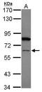 Zinc Finger Protein 449 antibody, GTX105470, GeneTex, Western Blot image 