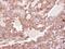 Rho GDP Dissociation Inhibitor Alpha antibody, GTX101428, GeneTex, Immunohistochemistry paraffin image 