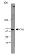 Nucleotide Binding Oligomerization Domain Containing 2 antibody, NB500-253, Novus Biologicals, Western Blot image 