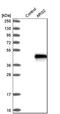 Arginase 2 antibody, NBP1-86189, Novus Biologicals, Western Blot image 