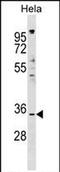 Impact RWD Domain Protein antibody, PA5-72005, Invitrogen Antibodies, Western Blot image 